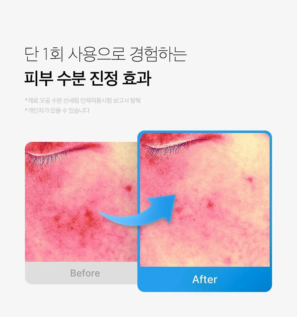 [수분진정/피지케어] 메디큐브 제로 모공 수분 선세럼 50ml 상세페이지 5